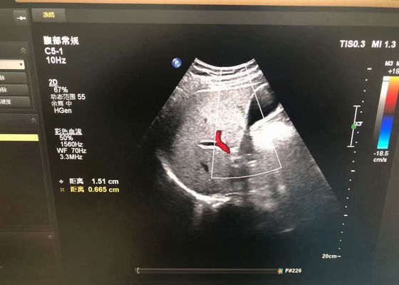 EPIQ 5装置のためのPhilip C5-1腹部医療超音波探査機