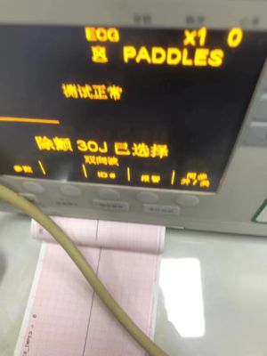ZOLL Mシリーズ デフィブリレーター 機械部品 修理 サービス 小売