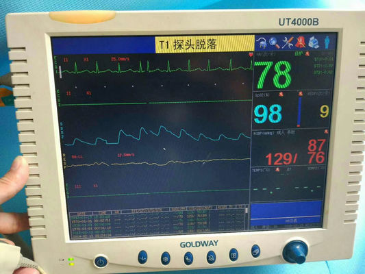 ゴールドウェイ UT4000B 患者モニター 修理 医療 患者モニター メンテナンス